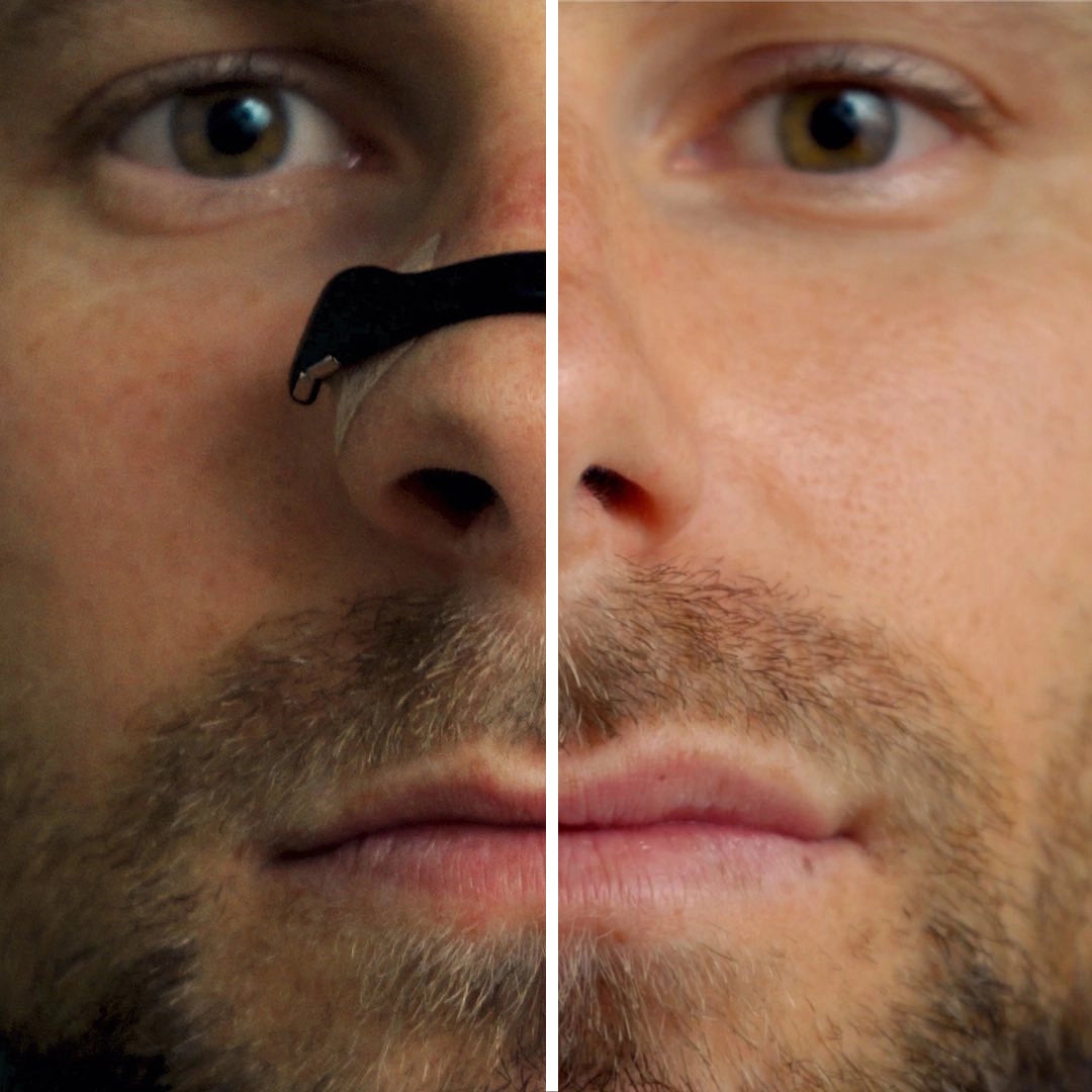 Respira con Más Comodidad Durante la Noche con NoseBand™ – La banda nasal Magnetica.