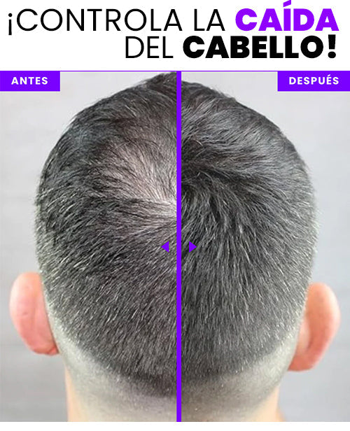 Restaurador de Canas y Raices Bunee® 🎁2x1🎁- Di adiós a las canas en segundos